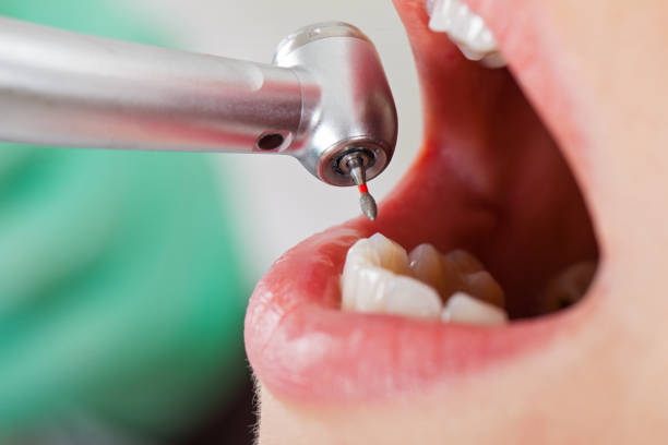 Best Orthodontic Emergency Dentist in Inverness Highlands North, FL